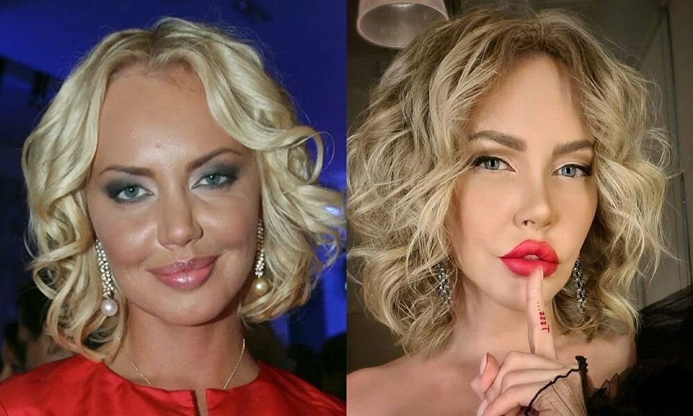 Маша малиновская губы до и после фото
