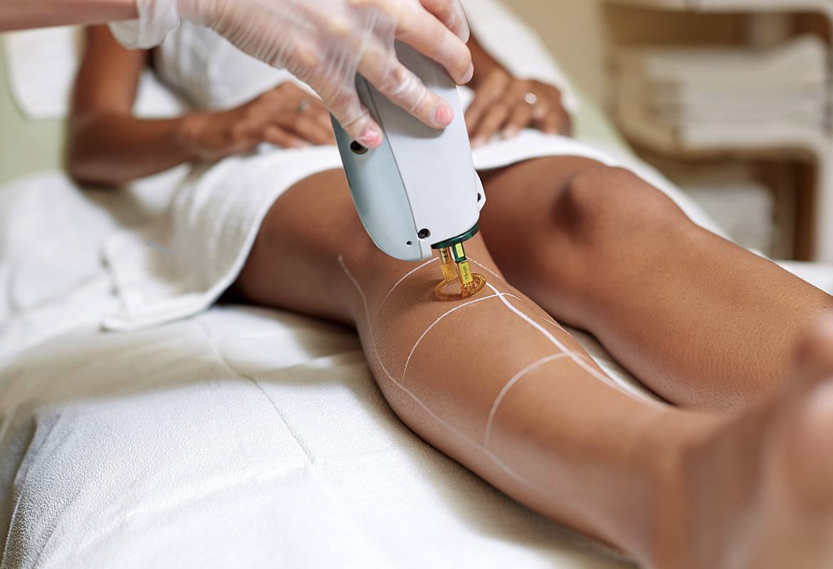 Как делать депиляцию на ногах. Diode Laser hair removal. Лазерная эпиляция оборудование. Лазер диодный или фотоэпиляция. Перманентное удаление волос.