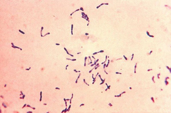 
Corynebacterium diphtheriae
