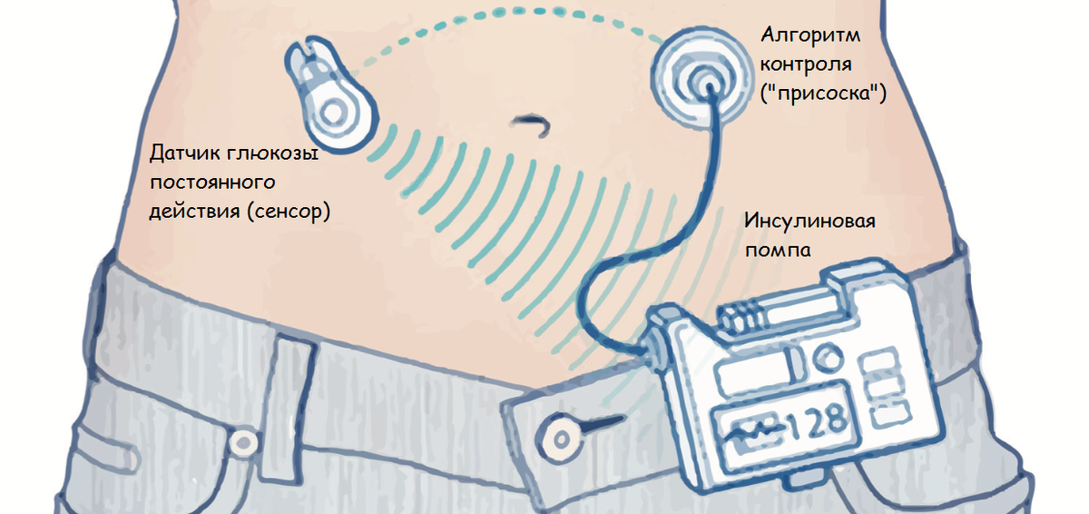 Фото: saxarvnorme.ru
