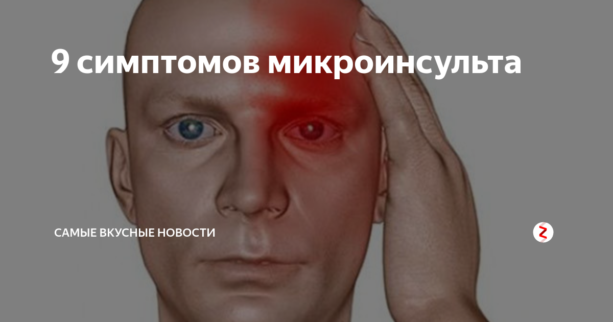 Микроинсульт симптомы первые. Микроинсульта. Симптоматика микроинсульта. Распознать микроинсульт. Клиника микроинсульта