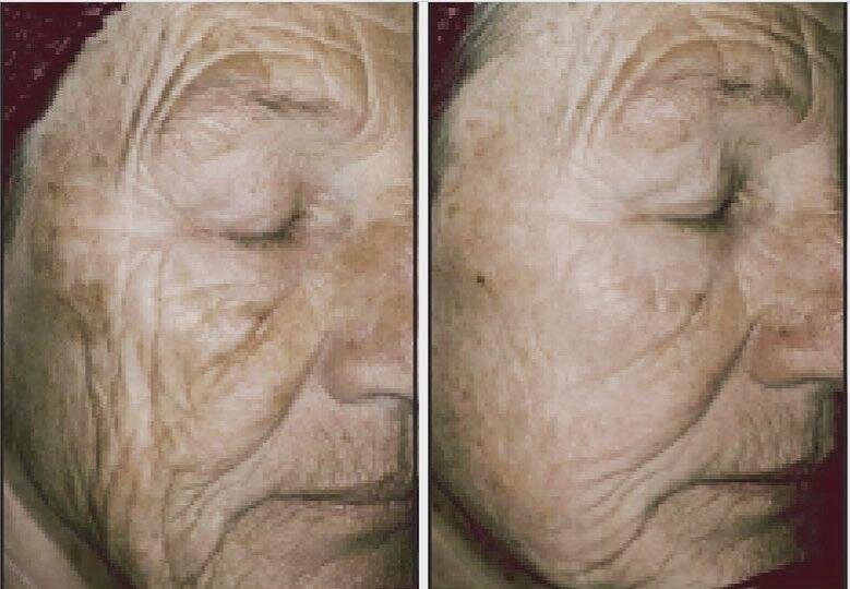 Лучше макияжа в 50-60 лет скрывает видимость морщин: о ретиноле и компонентах, которые с ним 