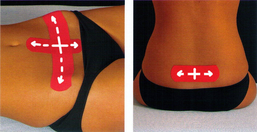 Изображение из книги "Medical taping concept" Harry Pijnappel.