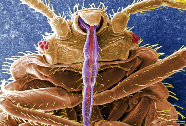 Ротовой аппарат блохи колюще-сосущего типа.