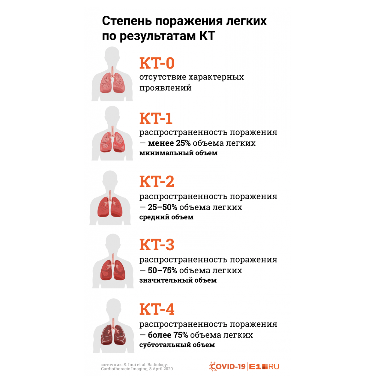 Что значит поражение. Ковид 75 поражение легких. Процент поражения легких. Легкие с 80 процентами поражения. 80 Поражения легких при коронавирусе.