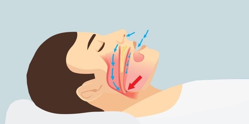 Храп — распространённая проблема. 45% взрослых храпят время от времени, а 25% — постоянно.