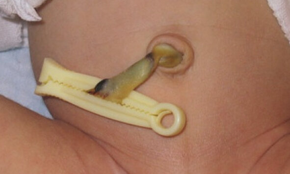 Картинка из интернета, но у нас была такая же вот прищепка