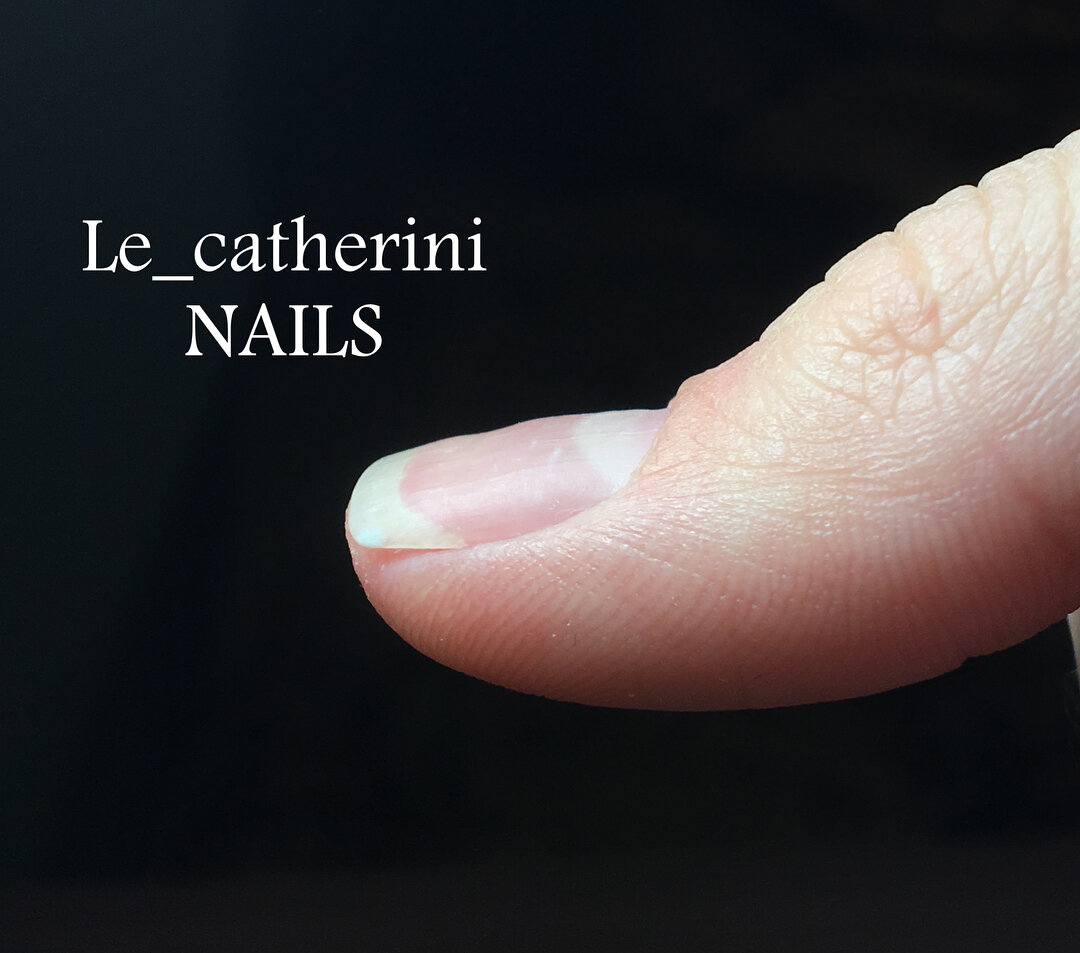 О чем говорят ногти? Из-за чего возникают бороздки, вмятины и пятна на ногтях?