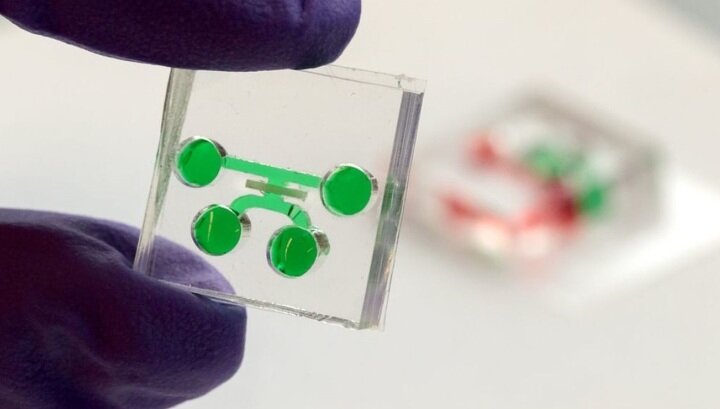 Зуб на чипе