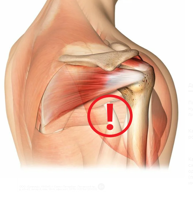 Плечевой сустав - один из самых уязвимых для травм