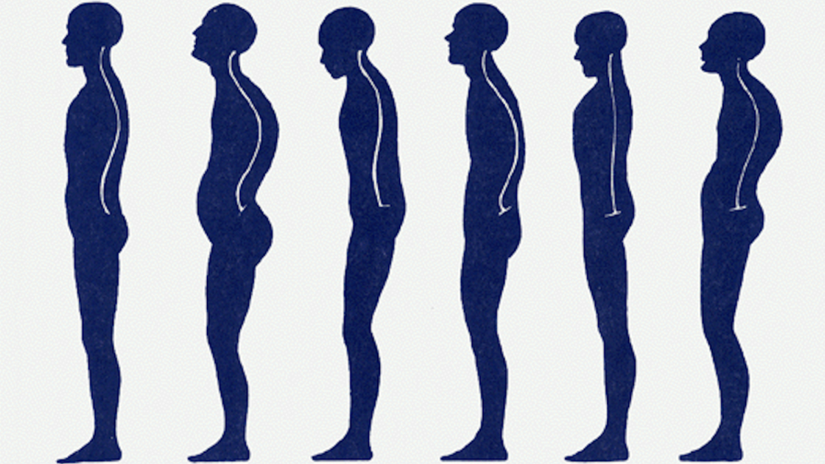 Виды позвоночника. Осанка. Круглая спина. Правильная осанка вид сбоку. Вялая осанка.