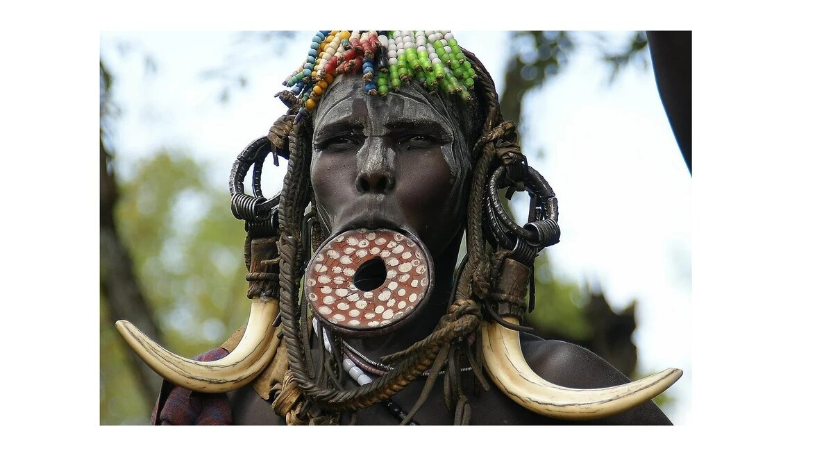 Так выглядит губная пластина