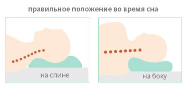 Чаще всего доктора отдают предпочтение анатомическим подушкам с удобными полуваликами, которые гарантирует столь необходимое расслабление шеи. Оптимальный вариант — ортопедическая подушка из материала с эффектом памяти. Она точно подстраивается под изгибы тела, не оказывает на него давления, дает улучшенную анатомическую поддержку.
