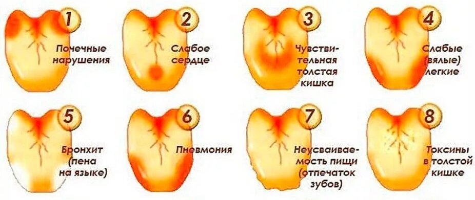 Желтый язык причины у взрослого фото ЖЕЛЧЬ В ЖЕЛУДКЕ - ПРИЧИНЫ И ЛЕЧЕНИЕ КДС Клиник Дзен