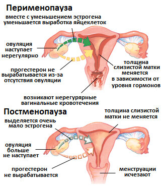 Постменопауза: причины, симптомы, лечение