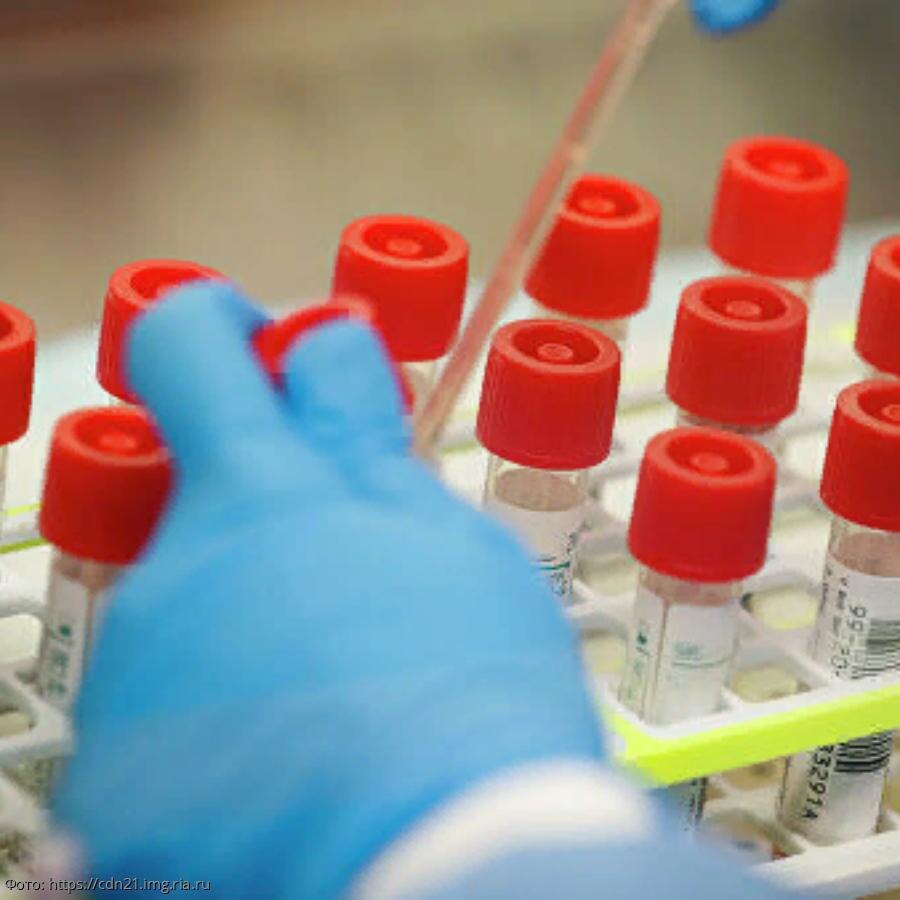 В Башкирии насчитывается сейчас 149 больных коронавирусной инфекцией. За сутки их стало больше на 20 человек.
