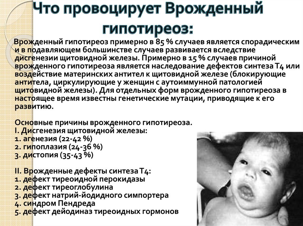 Врожденный гипотиреоз у детей презентация