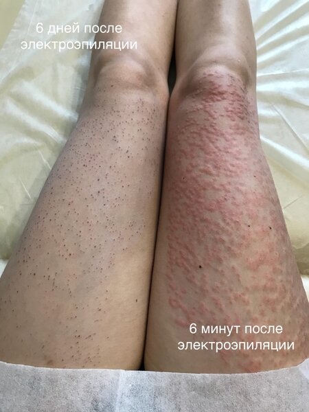 Источник: картинки из Яндекс и Гугл