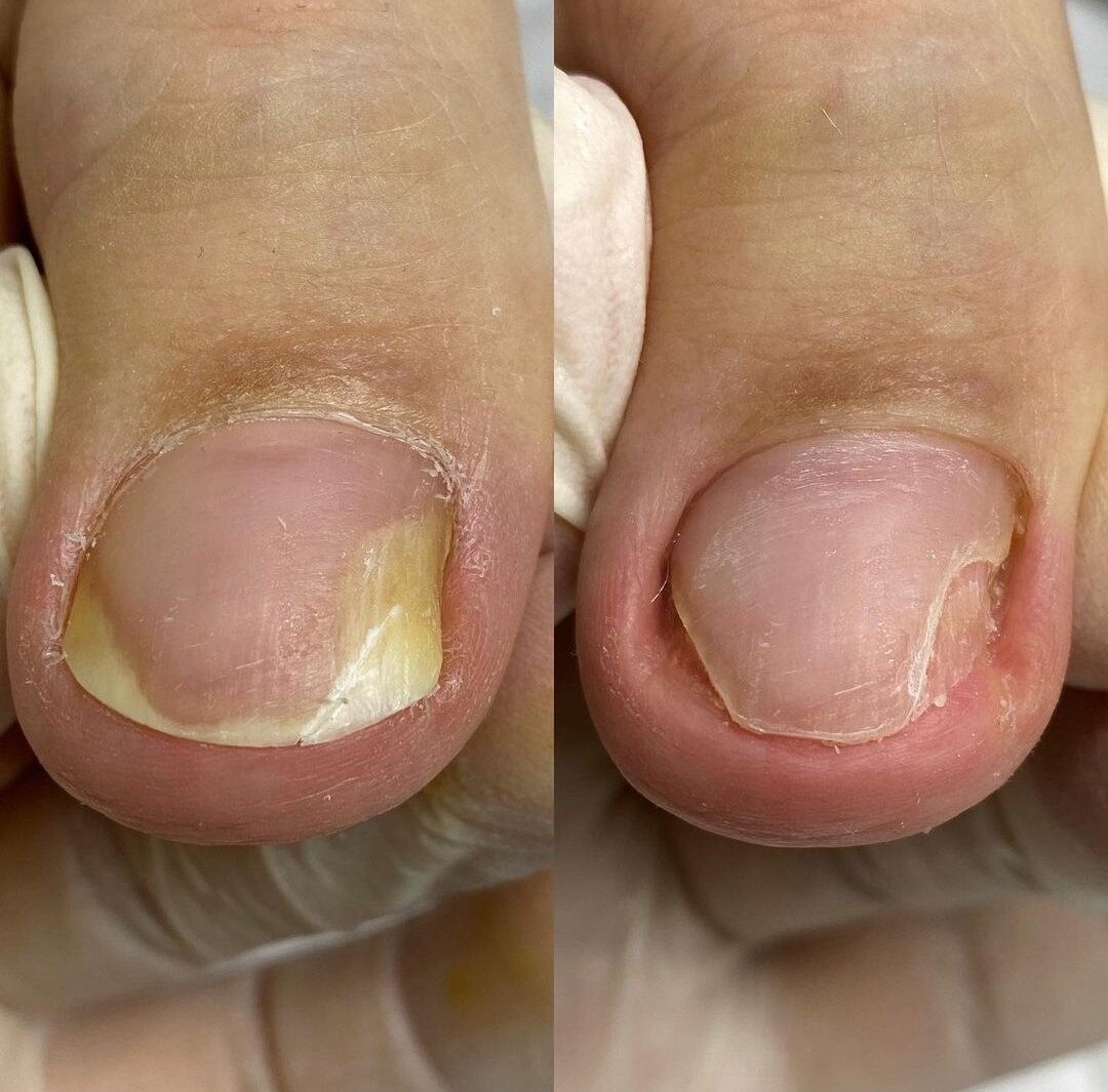 Фото взяла в Инстаграм из источника у @aksenova__anna_ 