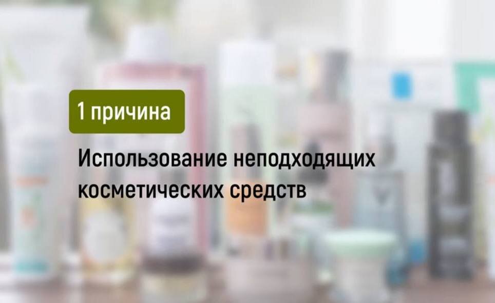 Много запросов в Директ я получаю о том, как избавиться от прыщей. Такая проблема может встречаться в любом возрасте – и у подростков, и у взрослых.-2