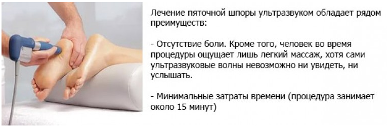 Как избавиться от пяточной шпоры навсегда. Пяточная шпора "лечение ультразвуком" методика. Как лечить пяточную шпору. Процедуры при пяточной шпоре. Лечение пяточных шпор.