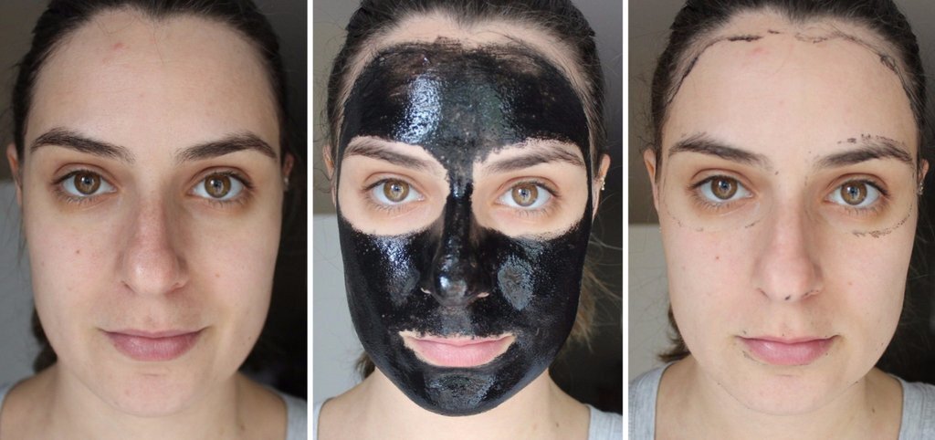 Маски для лица до и после. Угольная маска до и после.