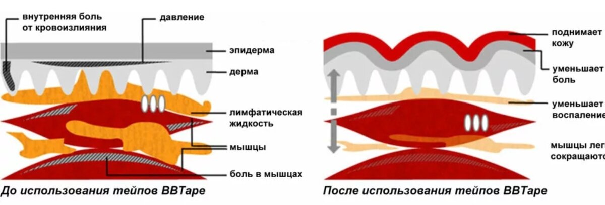 Фото взято в качестве иллюстрации у Яндекс-картинки 
