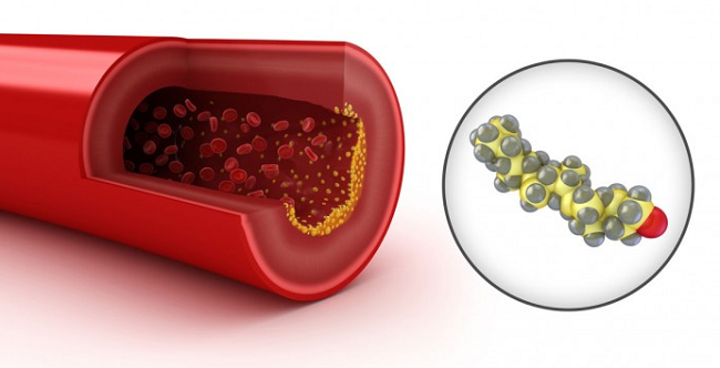 фото: http://www.dislove.ru/