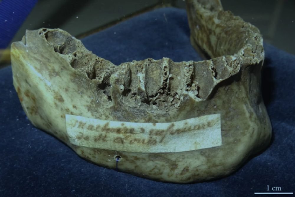 Текст: Денис Передельский327Фото: J Stomatol Oral Maxillofac Surg