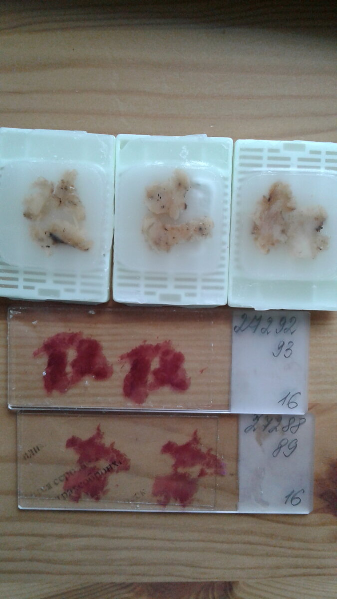 Стекла после гистологии. Стекла гистологического исследования. Забор материала для гистологического исследования. Предметные стекла для гистологии. Заливочный аппарат в гистологии.