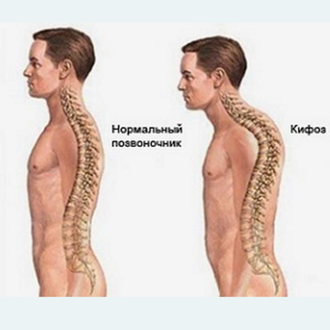 Источник: Яндекс. Картинки