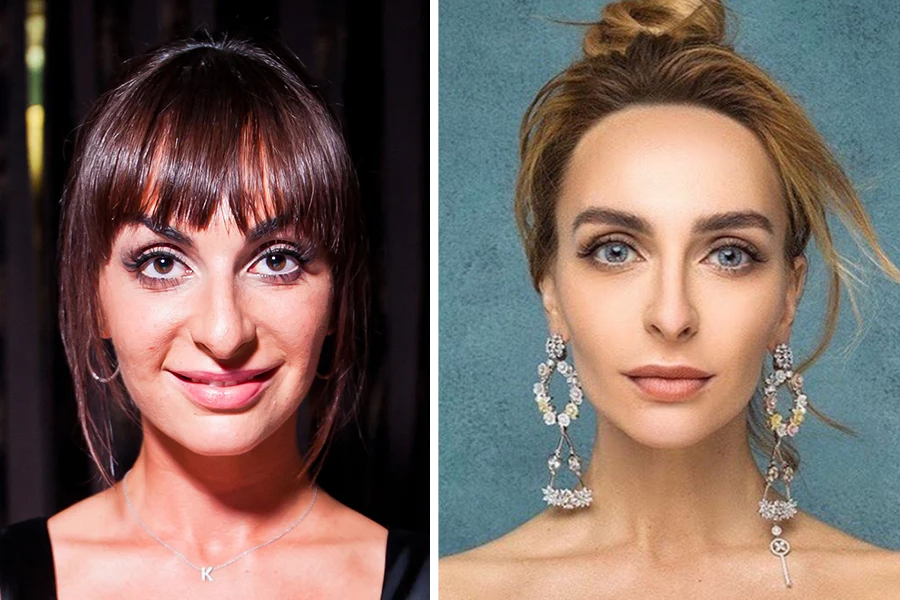 Екатерина Варнава до и после пластики: как изменилась внешность звезды  Comedy Woman | КиноБит | Дзен