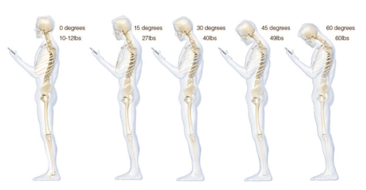 При наклоне на 60 градусов на шею приходится нагрузка, эквивалентная 27-килограммовому грузу, согласно исследованию врачей. С сайта https://hi-tech.mail.ru/news/cell-phone-destructs-spine/