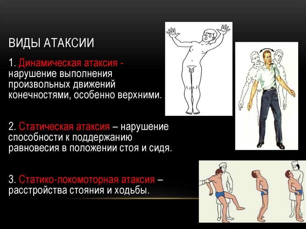 Нарушение координации картинки