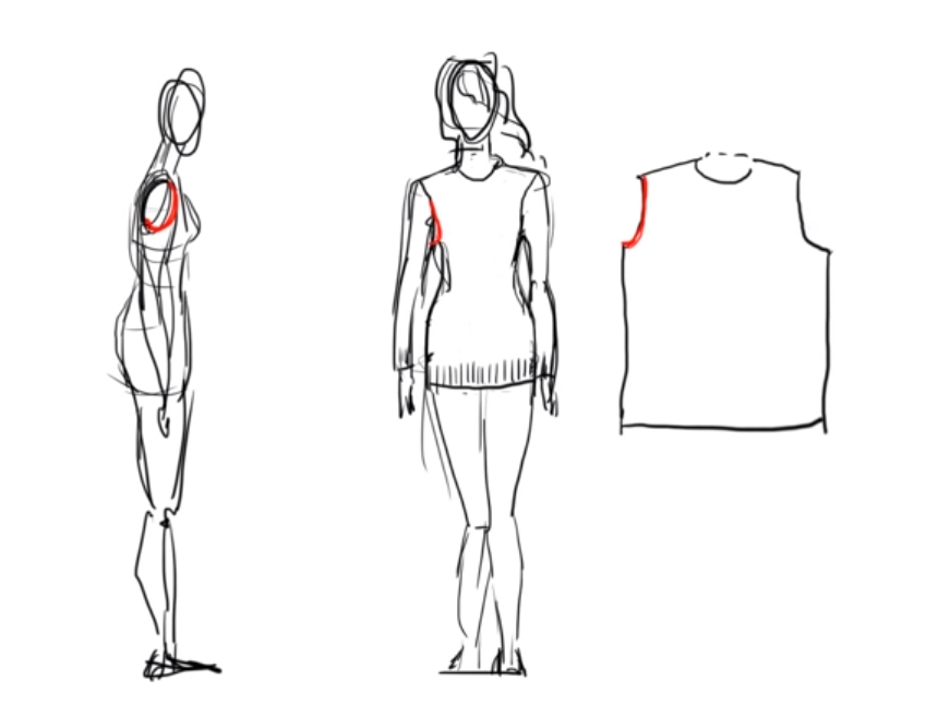 Заглубление подмышечной впадины в объеме и в проекции