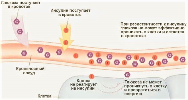 Инсулинрезистентность. Симптомы и лечение. - Блог - Alena Kogotkova