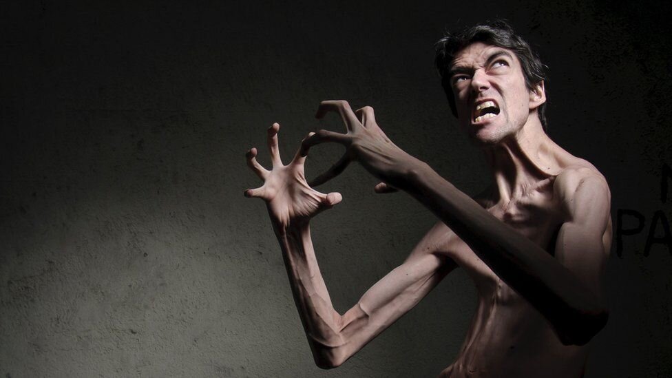 Javier Botet
