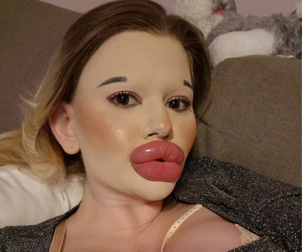 -2