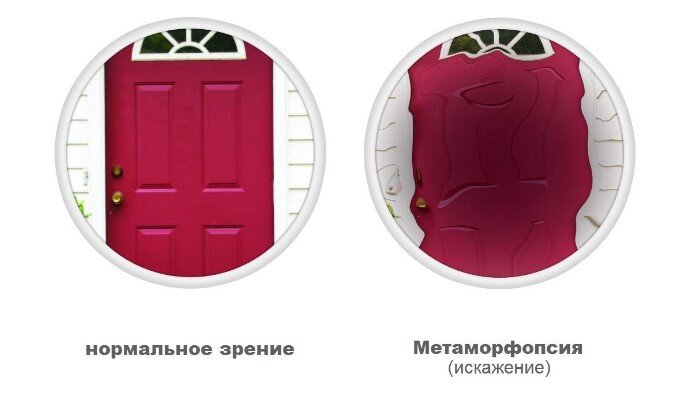 Метаморфопсия — мир в кривом зеркале