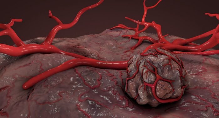 Опухоль формирует собственную кровеносную сеть (Фото: Static.turbosquid.com)