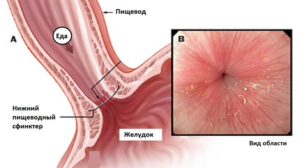 Капельницы на дому в Марьино (Люблино, Братиславская)