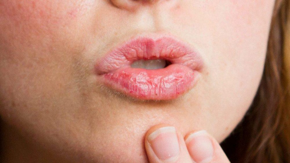 Обветренные губы и что с этим делать - блог Cleo Line