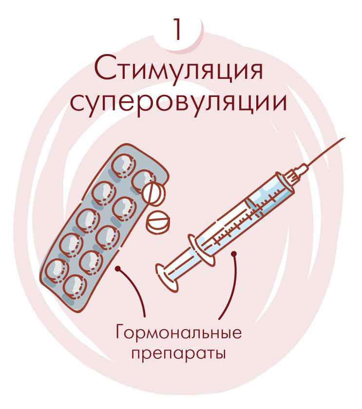 ᐈ 1 этап ЭКО: подготовка, начало и стимуляция суперовуляции в клинике репродукции ICLINIC в СПб