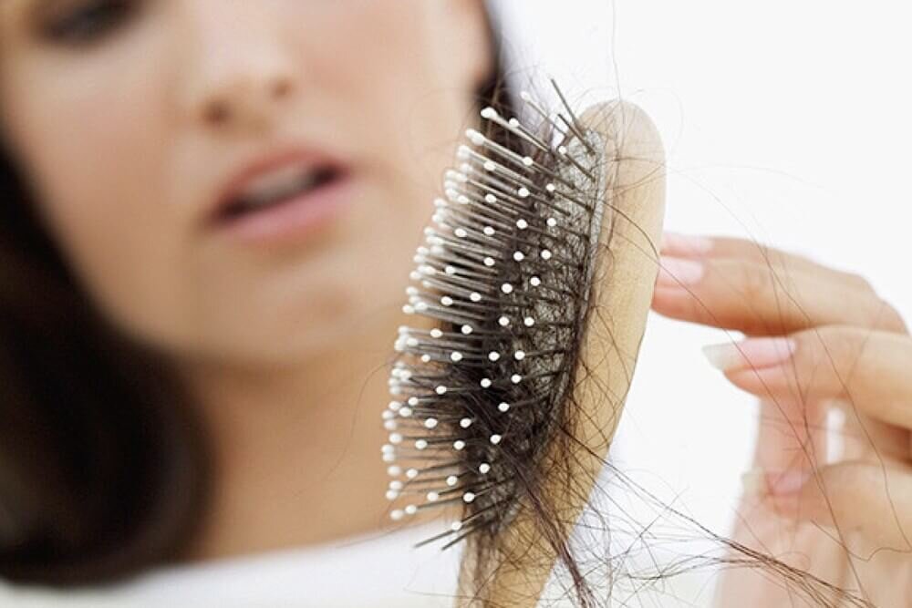 Каждой женщине необходимо знать индивидуальную норму выпадения волос. В среднем это 50-150 штук в день.-2