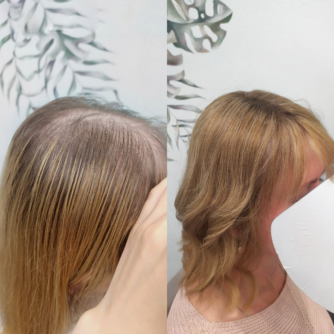 Фото клиентки с накладкой 🔥 Кстати, корни на изделии я окрасила в цвет корней девушки)