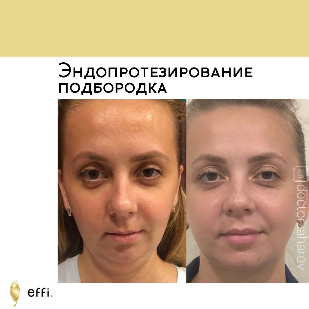 Клиника косметологии и пластической хирургии effi. Красноярск. Пластический хирург - Захаров Сергей Яковлевич 