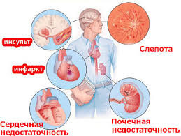 Гипертония влияет на все органы и системы!