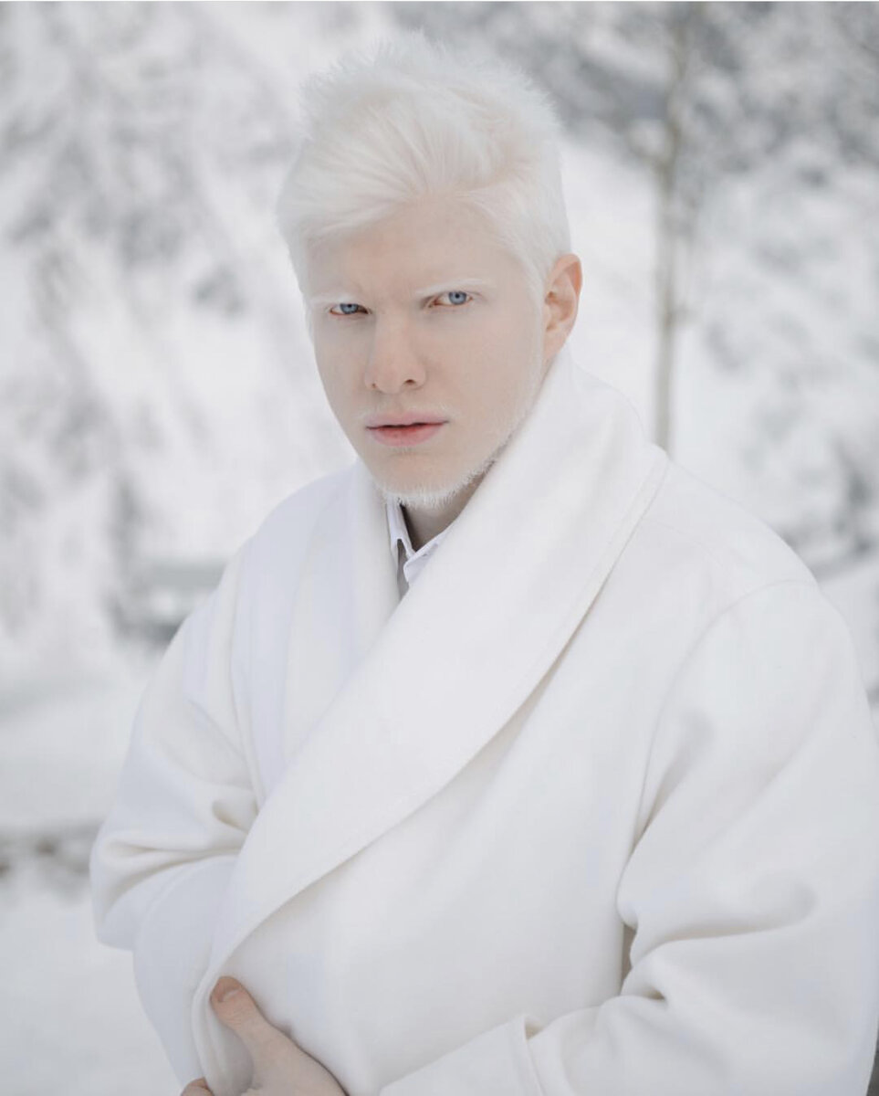 Бера Иванишвили альбинос