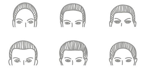 Виды линий роста волос