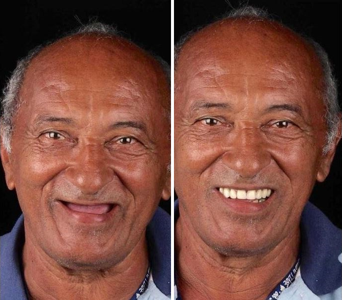 Красивые зубы действительно преображают человека